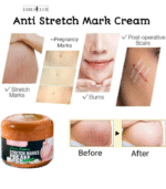 Stretch Mark Remover Cream – Smooth & Nourish Your Skin - Image 2